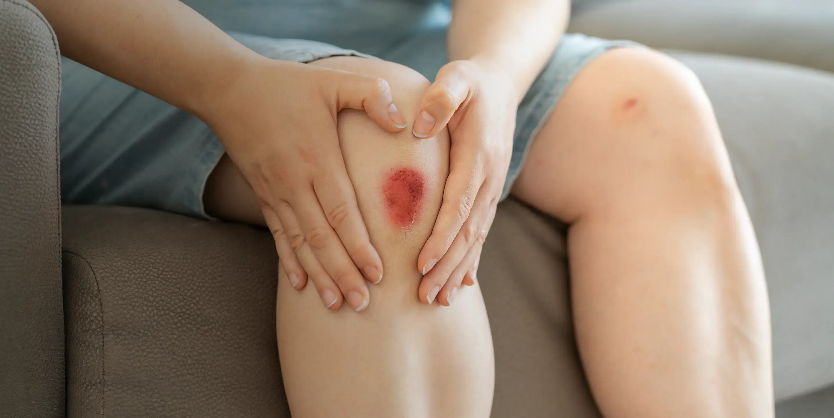 What is Wound Care at Home?