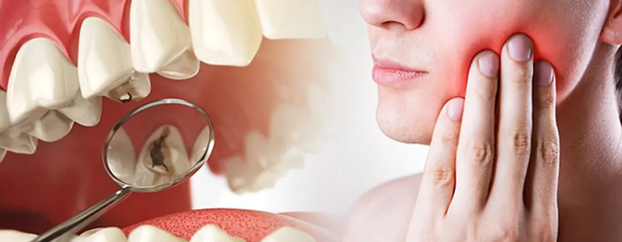 Cavities and Tooth Decay: Early Signs and How a Dentist at Home Can Help