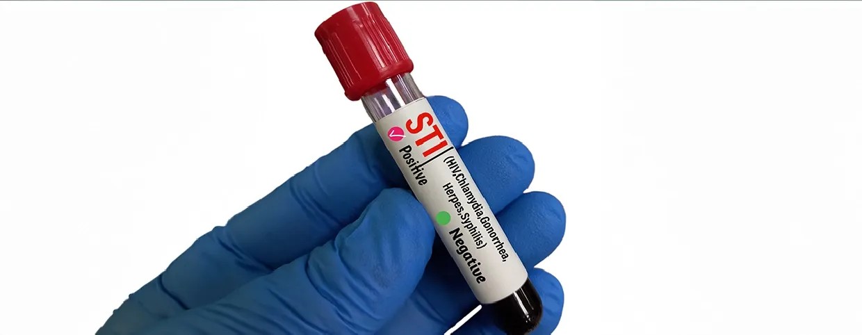 Chlamydia vs Gonorrhea: All You Need to Know