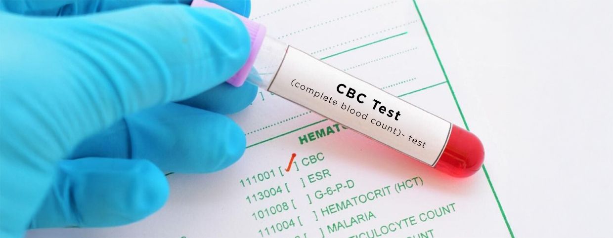 Why is a CBC Test Important?