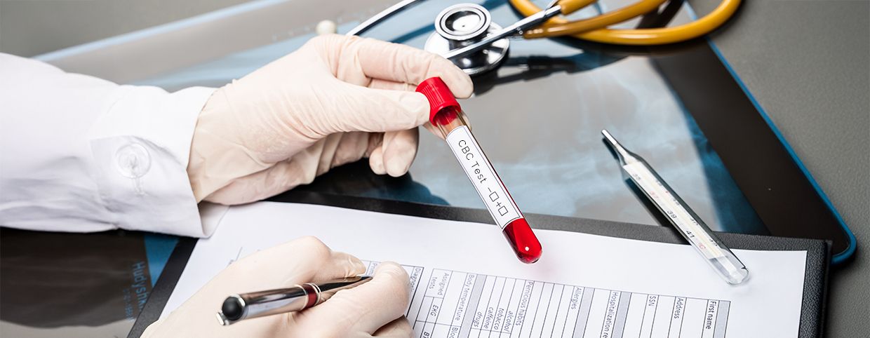 Complete Blood Count (CBC): What It Measures and Means?