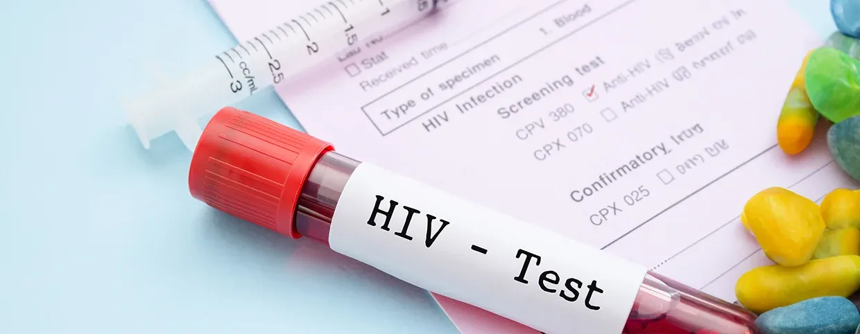 HIV Symptoms in Men: What to Watch Out For?