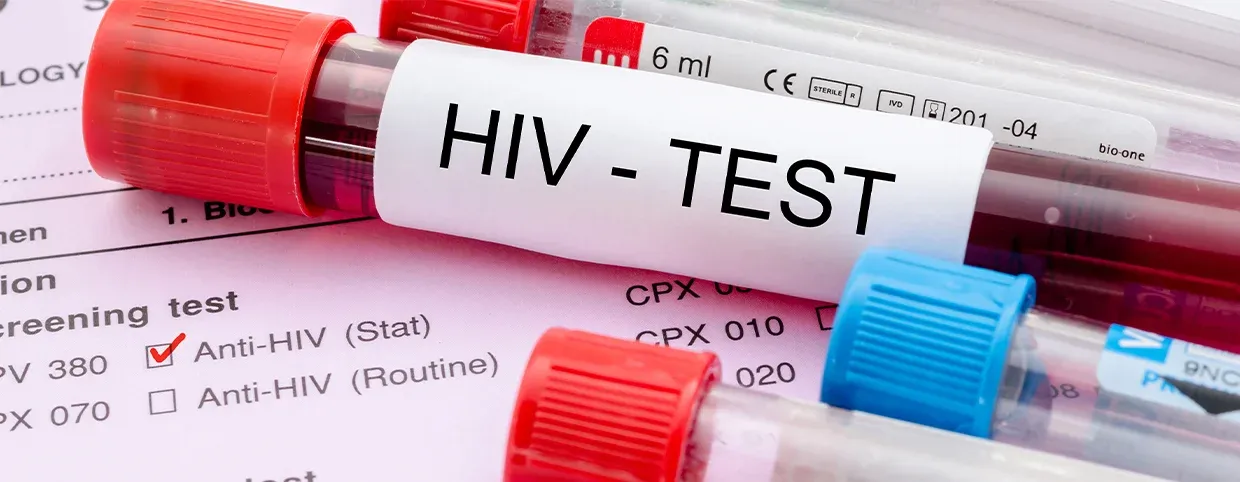 Early Signs of HIV: Key Symptoms Women and Men Should Look Out For