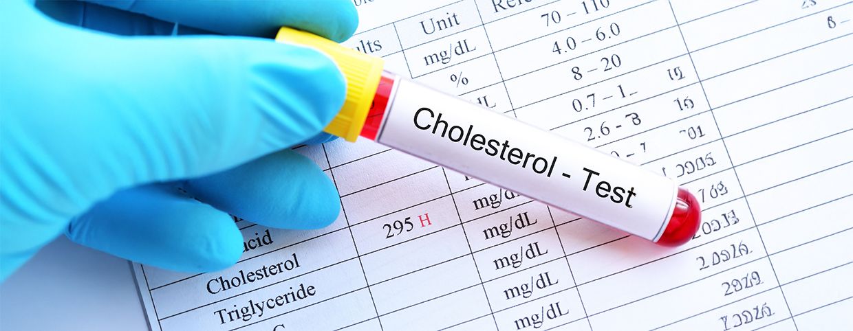 Health Checkup at Home and Lab Tests at Home
