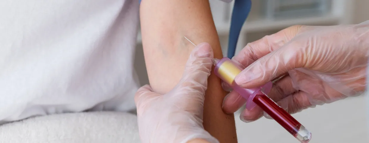 Benefits Of Hiv Testing At Home For The Community At Large