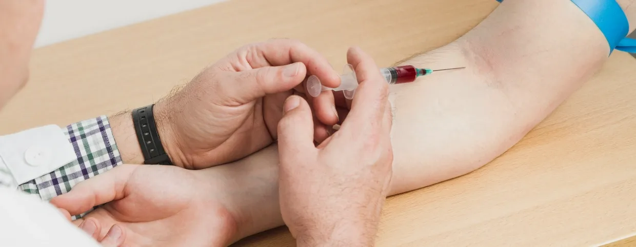 اختبار فيروس نقص المناعة البشرية في المنزل: كيف يعمل وما الذي يجب مراعاته؟