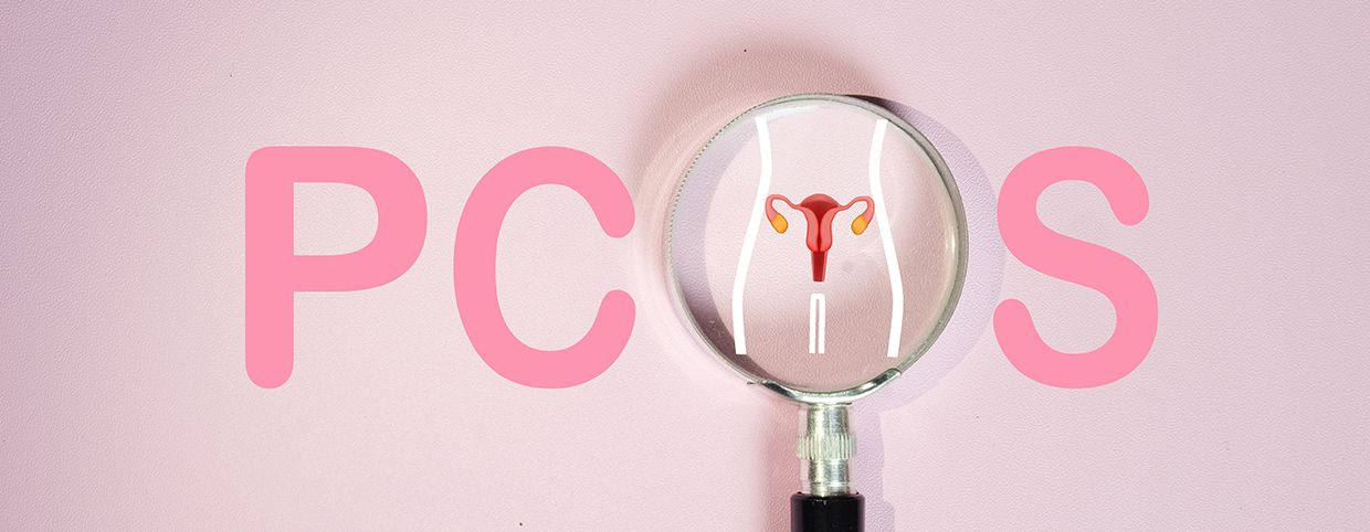 PCOS Diagnosis: Symptoms, Tests, and Medical Evaluation