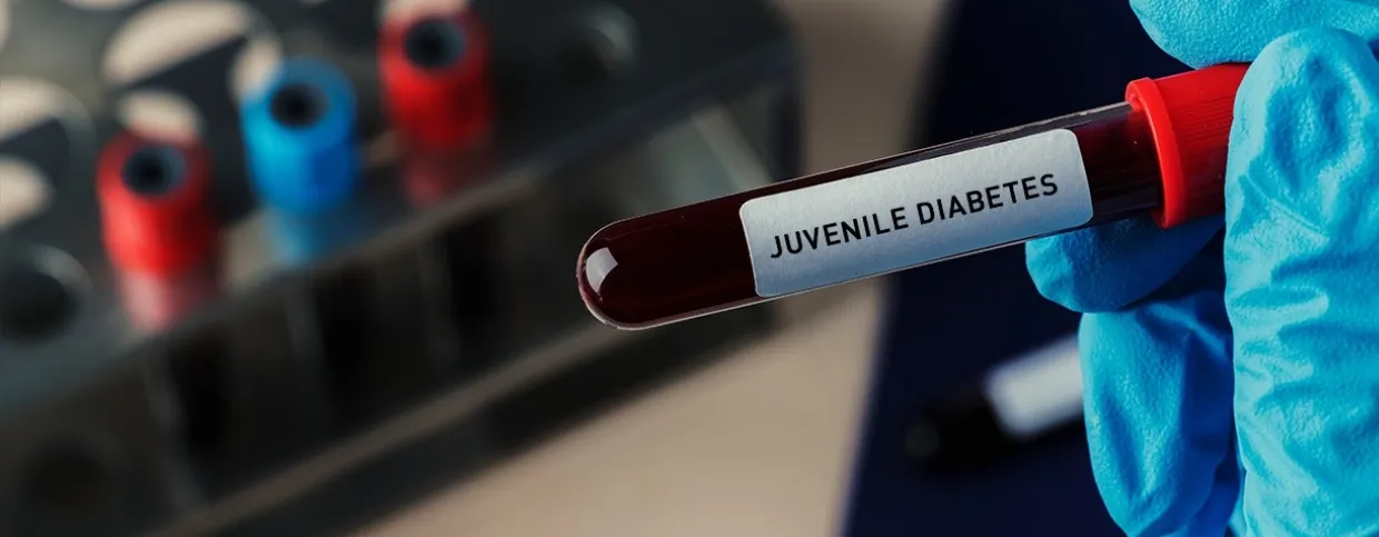 Causes and Risk Factors for Juvenile Diabetes