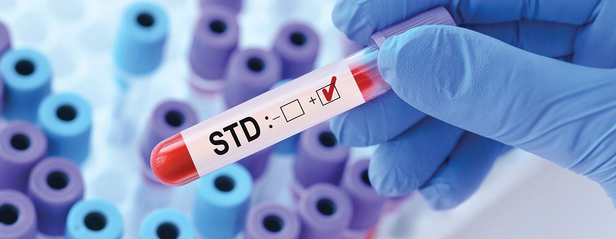 Symptoms of Sexually Transmitted Infections