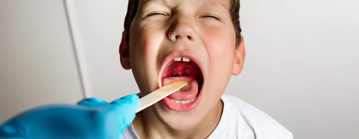 The Process of Initiation of Tonsillitis