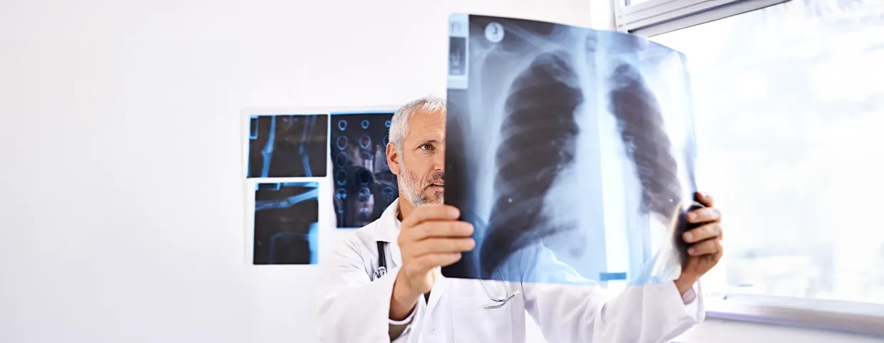 Lung Cancer Explained: Symptoms, Causes & Early Diagnosis