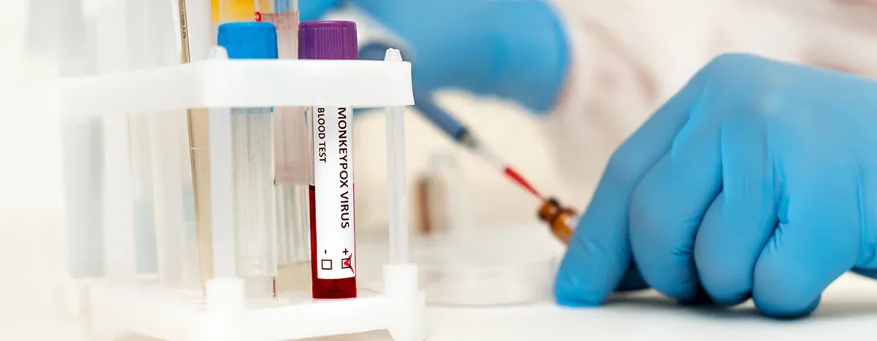 كيف ينتقل مرض امبوكس؟