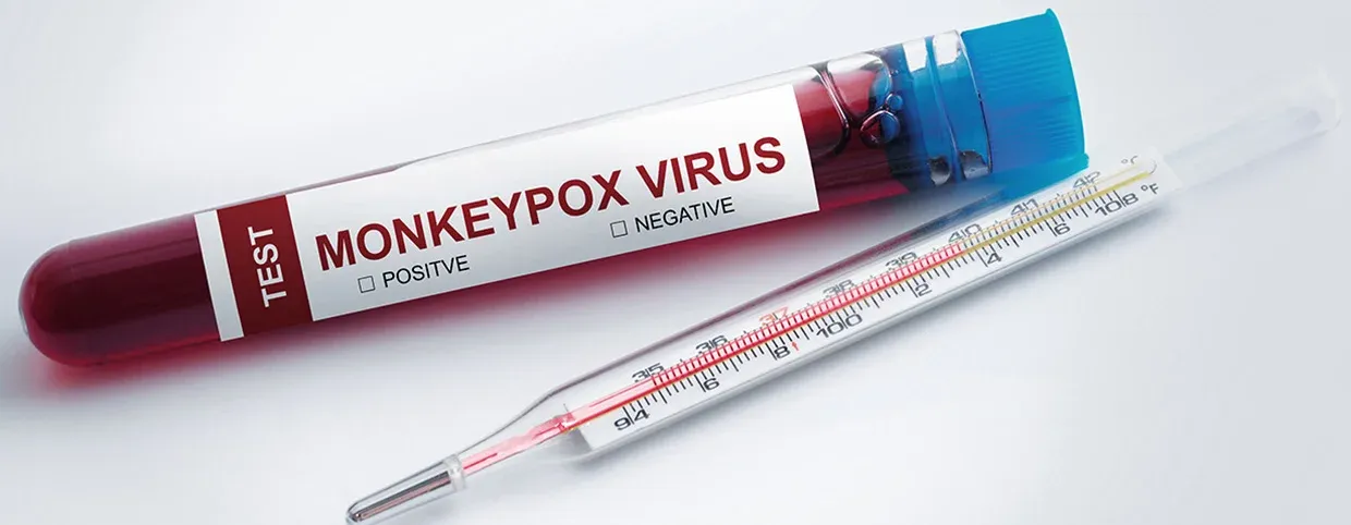 Understanding Mpox (Earlier Called As Monkeypox): Symptoms, Transmission and Prevention