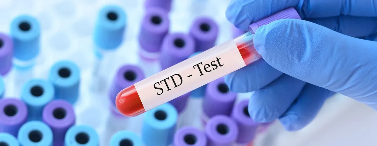 Understanding Sexually Transmitted Diseases (STDs): Basics
