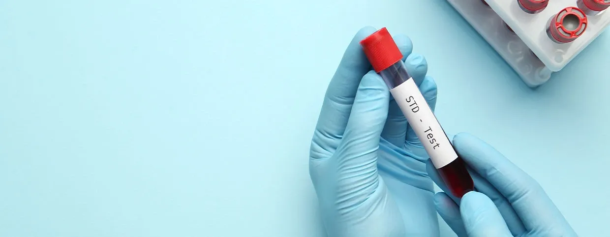 Understanding STD Testing: A Guide To Early Detection