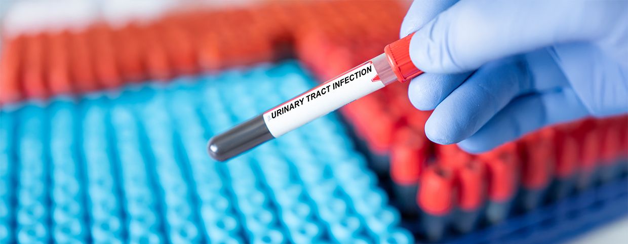 UTI in Men: Symptoms and Treatment Explained